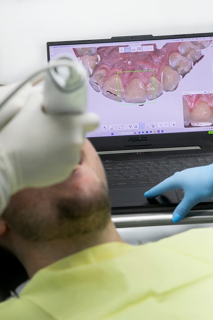 Sedación consciente para cirugía dental en Zaragoza